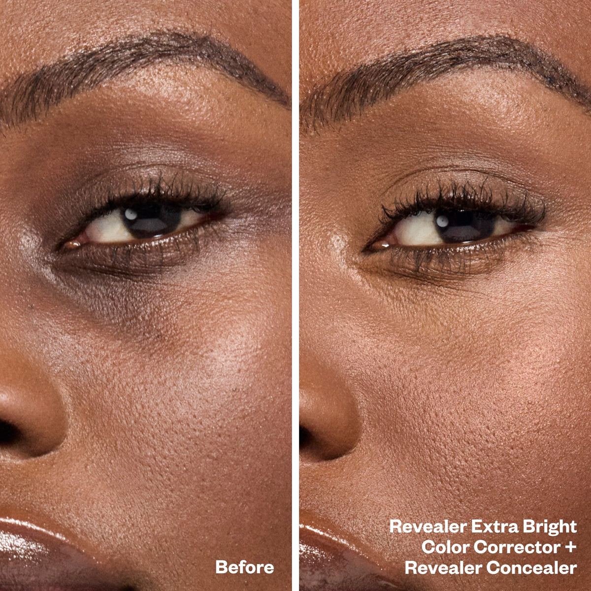 Before and After Bright Eyes Set